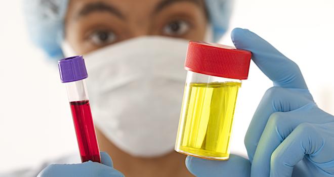 Blut im urin durch viagra