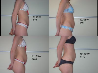 Propecia absetzen schwangerschaft Propecia absetzen schwangerschaft